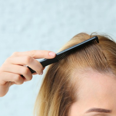 Caída del cabello, soluciones eficaces para prevenirla